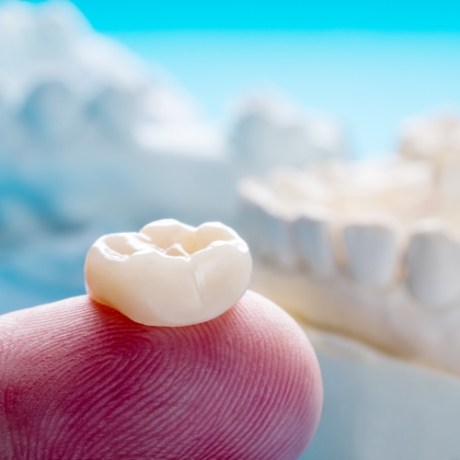 White dental crown in Corinth resting on a finger