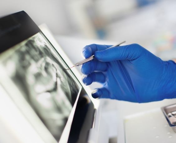 Dentist looking at x ray of teeth