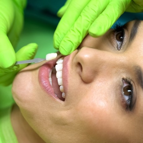 Dentist holding shade guide to a patients teeth